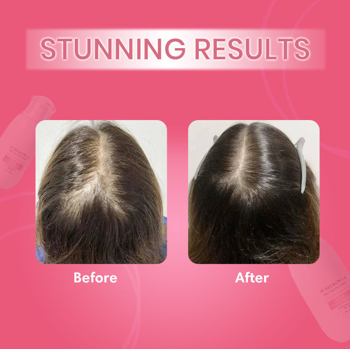 Rice Nutri Spray