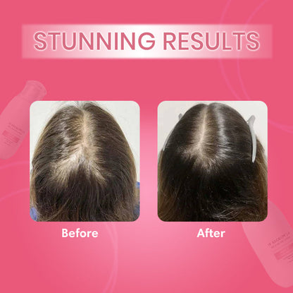Rice Nutri Spray